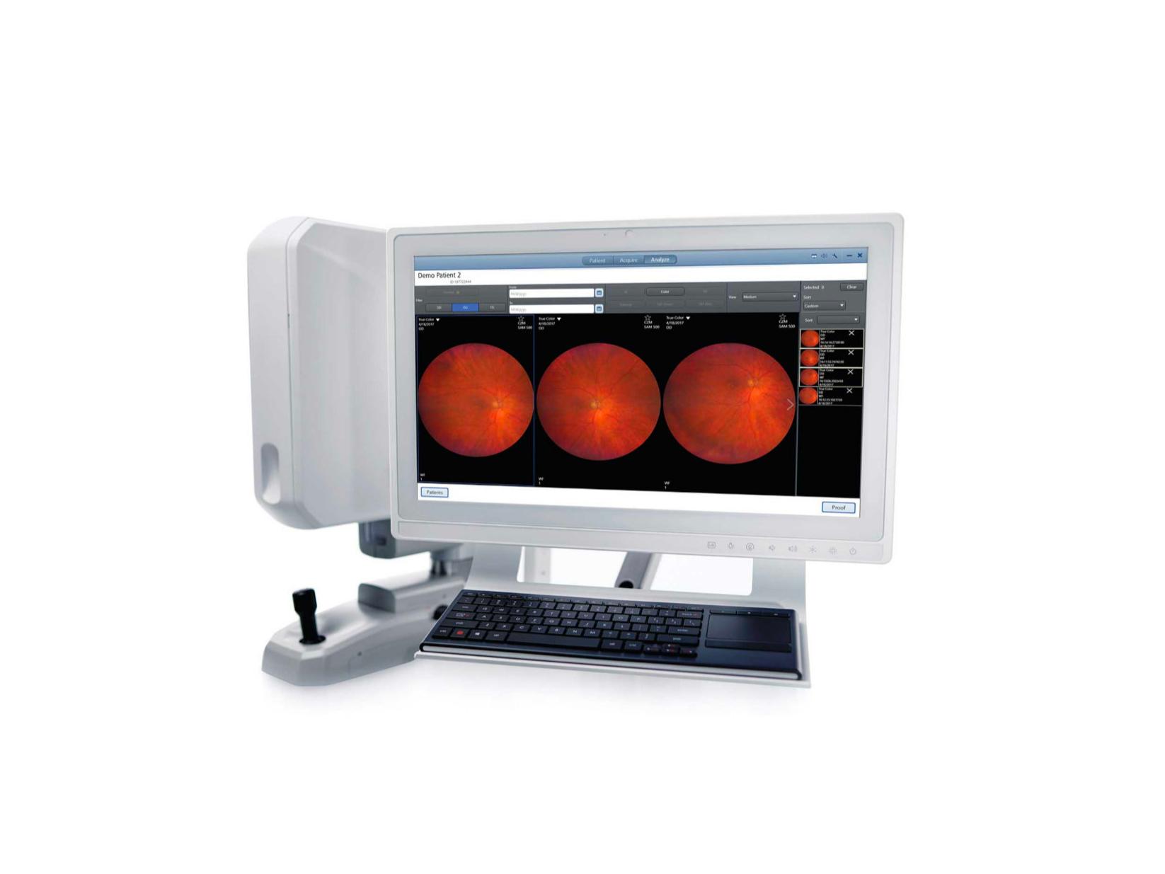 Câmaras da retina ZEISS