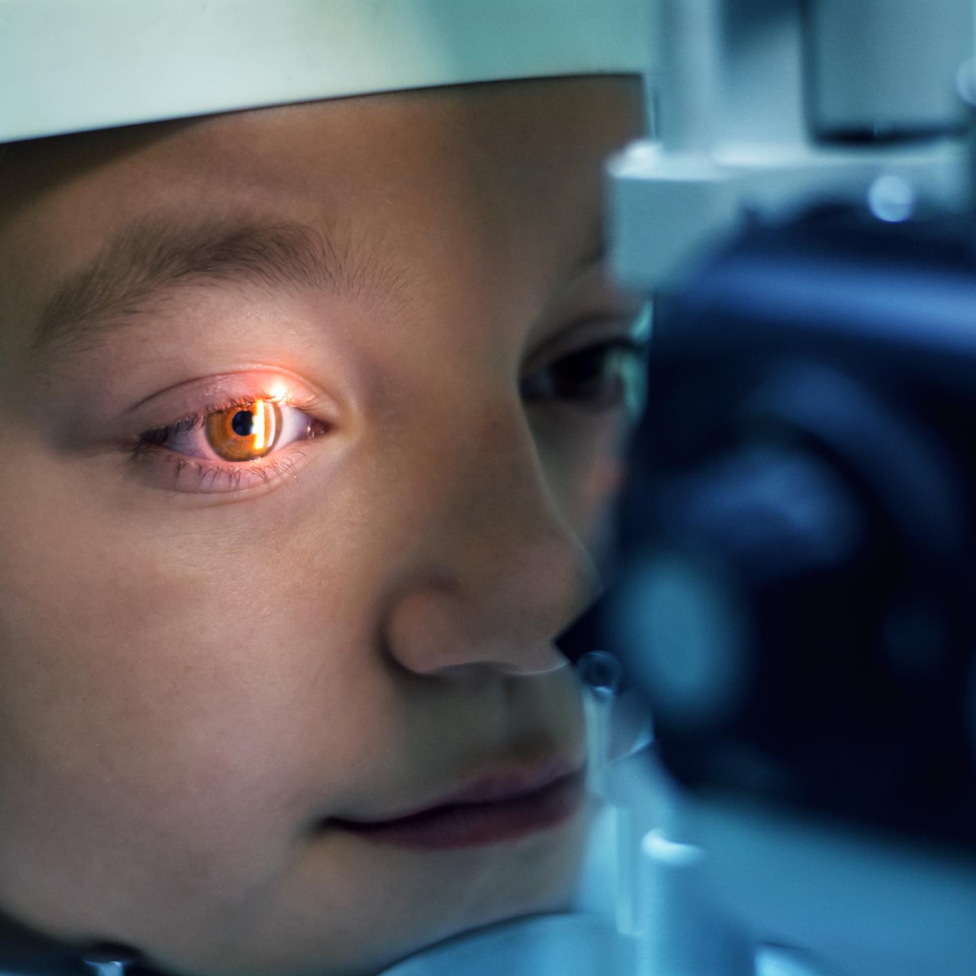 Ectasia corneal (inchaço da córnea)