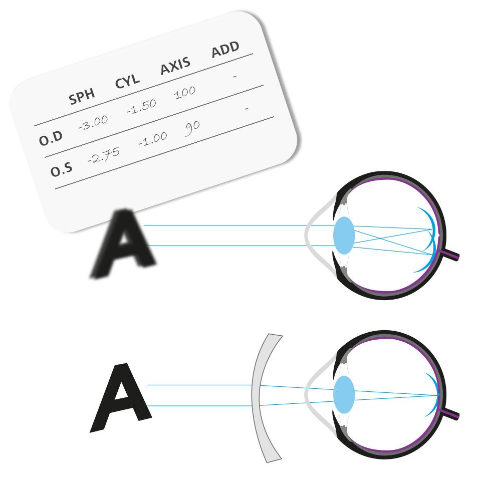 Prescrição com números na coluna CYL/CIL e AXIS/EIXO
